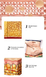 RtopR Mango Slimming Cream Body Cream